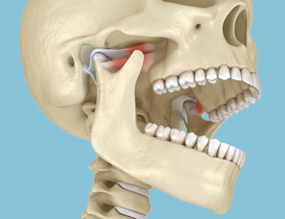TMJ-Treatment TMJ Treatment in Potomac MD