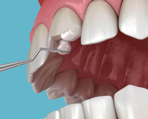 Restorative Dentistry Potomac Maryland